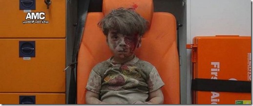 Aleppo - Gewond jongetje van het Aleppo Media Center - 18 augustus 2016
